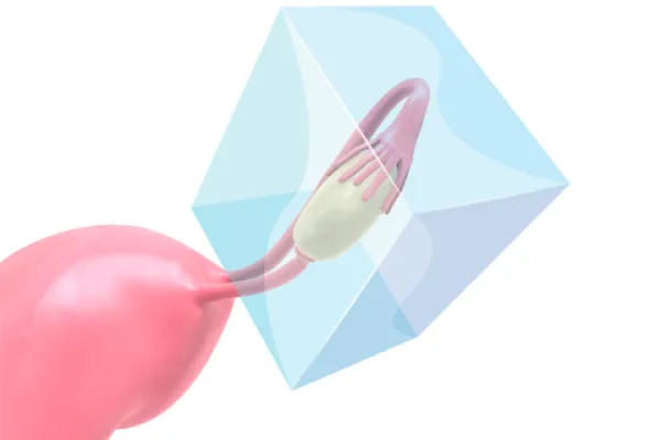 Onkofertilitet reproduktivna onkologija