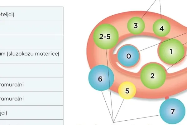 Miomi na materici: pristupi, lečenje i uticaj na fertilitet